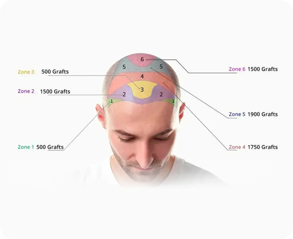 Group 1000001598 pricing options hair transplant