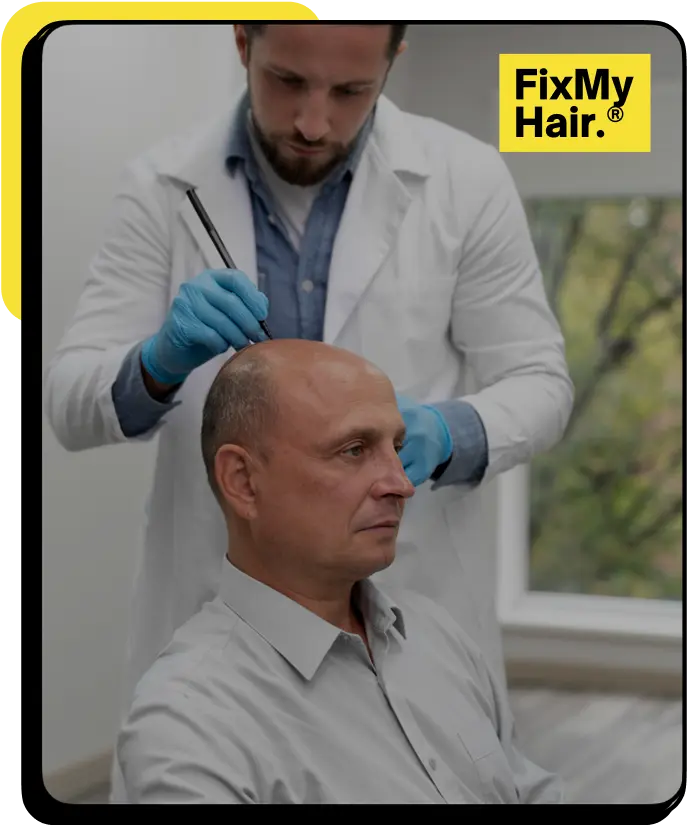 02 hair transplant fixmyhair