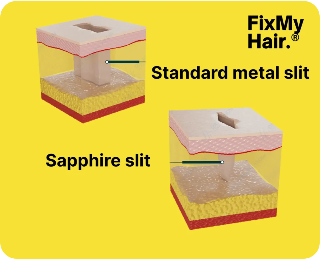 Group 1000001664 Hair Transplant