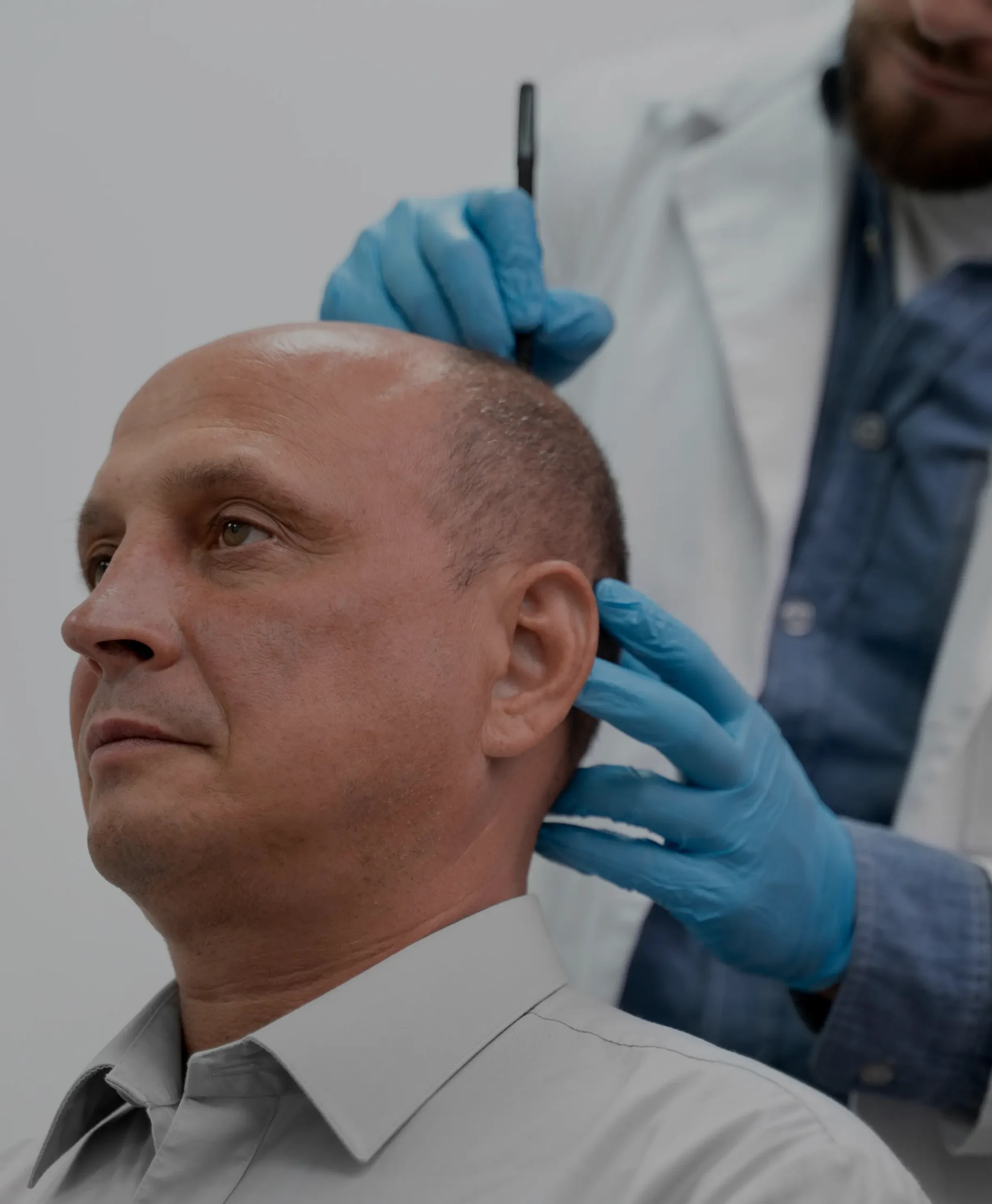 Mature Man FUE Process