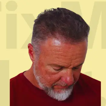 After Hair Fix Results