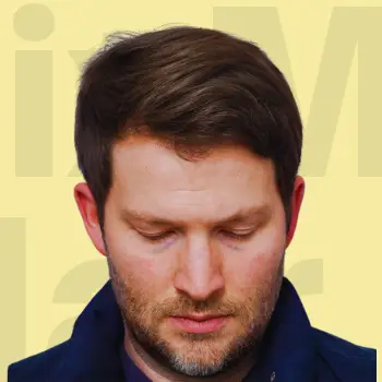 After Hair Treatment Result