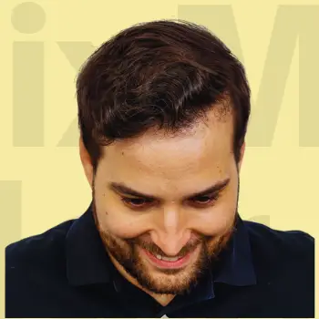 After Hair Fix Results