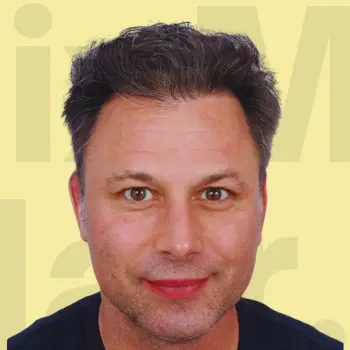 After Hair Treatment Result