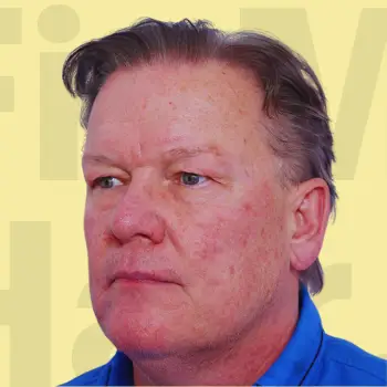 After Hair Treatment Result