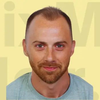 Hair transformation after fix.