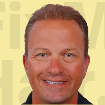 after taking the hair transplant treament with Fix My Hair UK