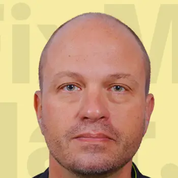 Before Hair Transformation Result