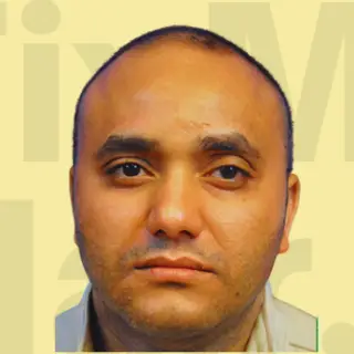 Before hair transformation result.