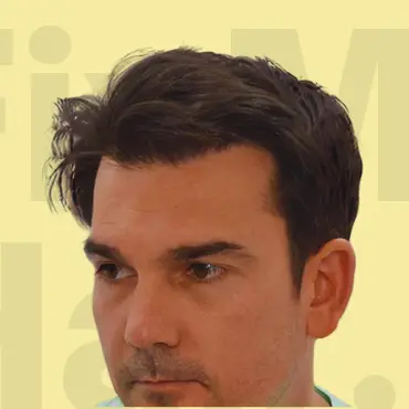 After Hair Treatment Result