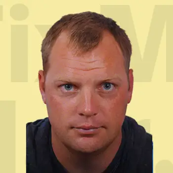 Before hair treatment result.