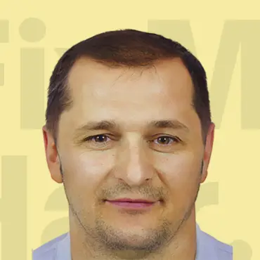 Hair transformation after treatment.