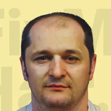 Before hair transformation results.