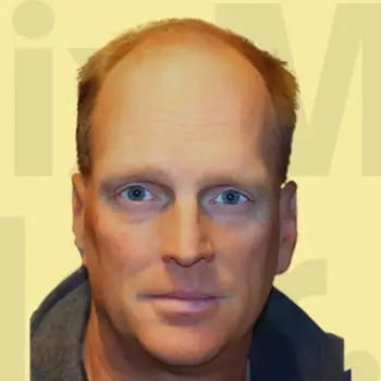 Before Hair Transformation.