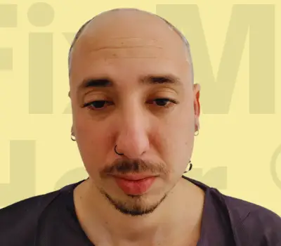 Hair transformation before image.