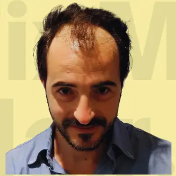 Before hair treatment comparison.