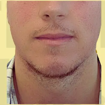 Before repair service image.