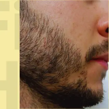 Before Repair Service Image