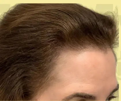 After Repair Service Image