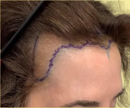 Before repair service image.