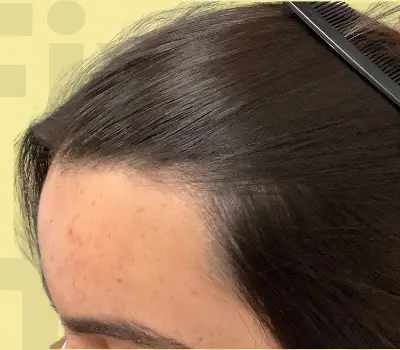 After Repair Service Image