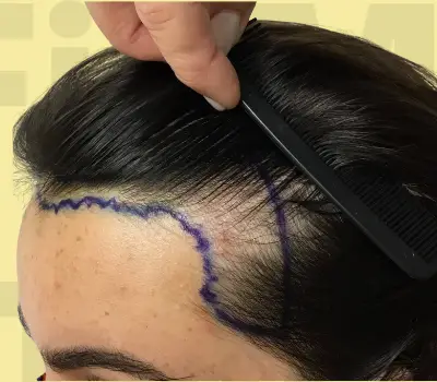 Before repair service.