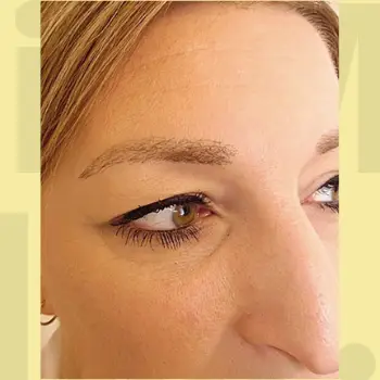 Hair Transformation After Fix