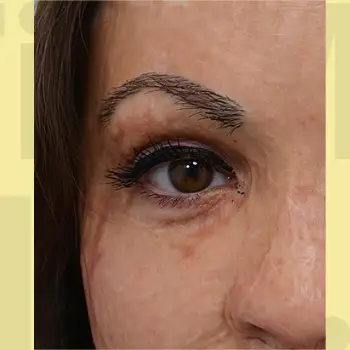 after taking the hair treament with Fix My Hair UK