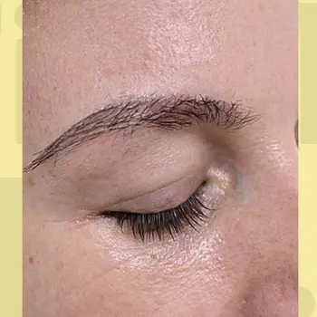 After Hair Fixing Results