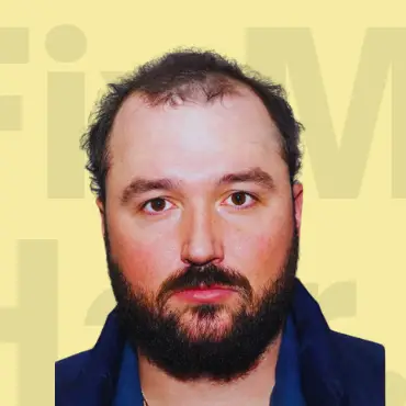 Before Hair Treatment Results