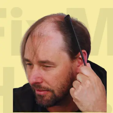 Before Hair Treatment Results