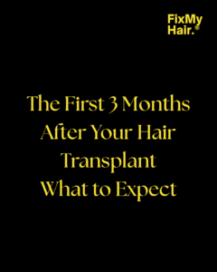 Hair Loss Treatment Options
