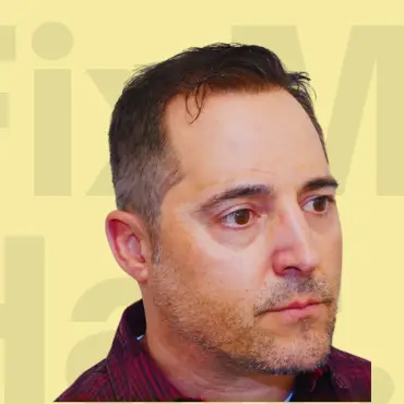 Hair transformation after treatment.