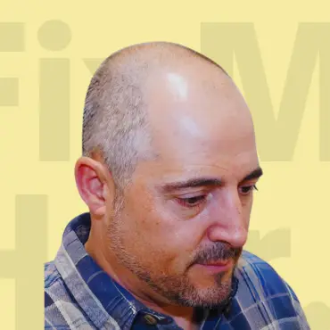 Before hair treatment results.