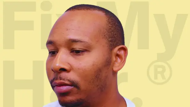 Before Hair Treatment